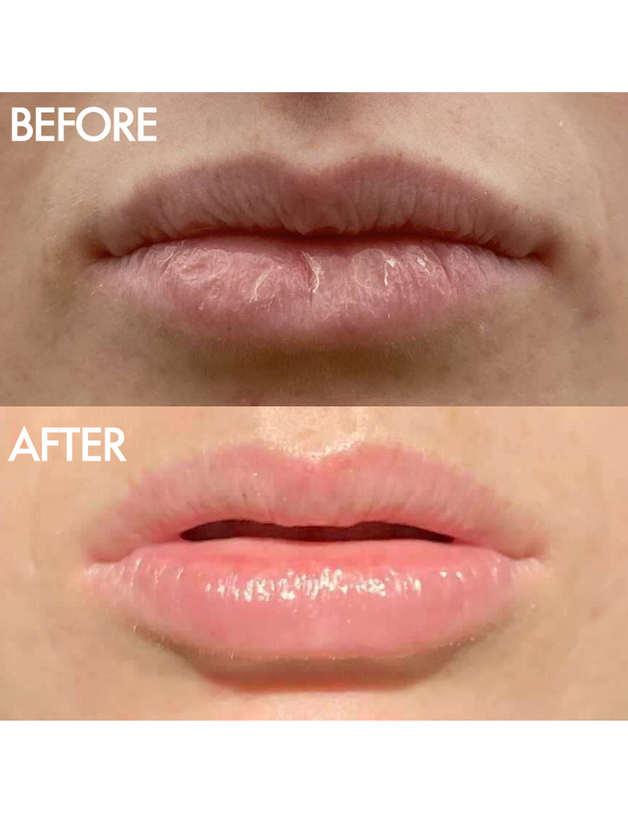 Multipurpose Superbalm