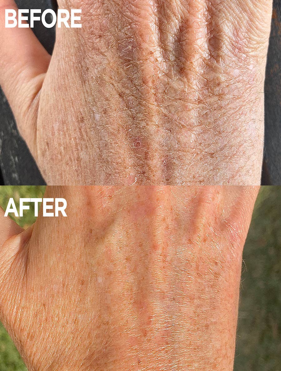 Golden Dry Skin Miracle Salve