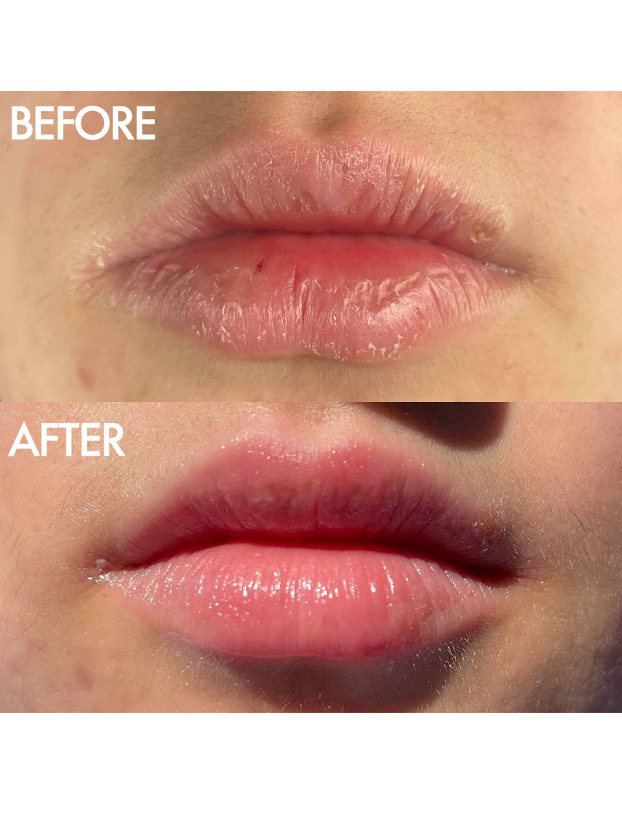 Multipurpose Superbalm