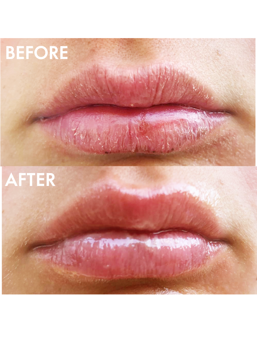 Multipurpose Superbalm