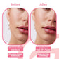 ClearLip™ Cold Sore Wand