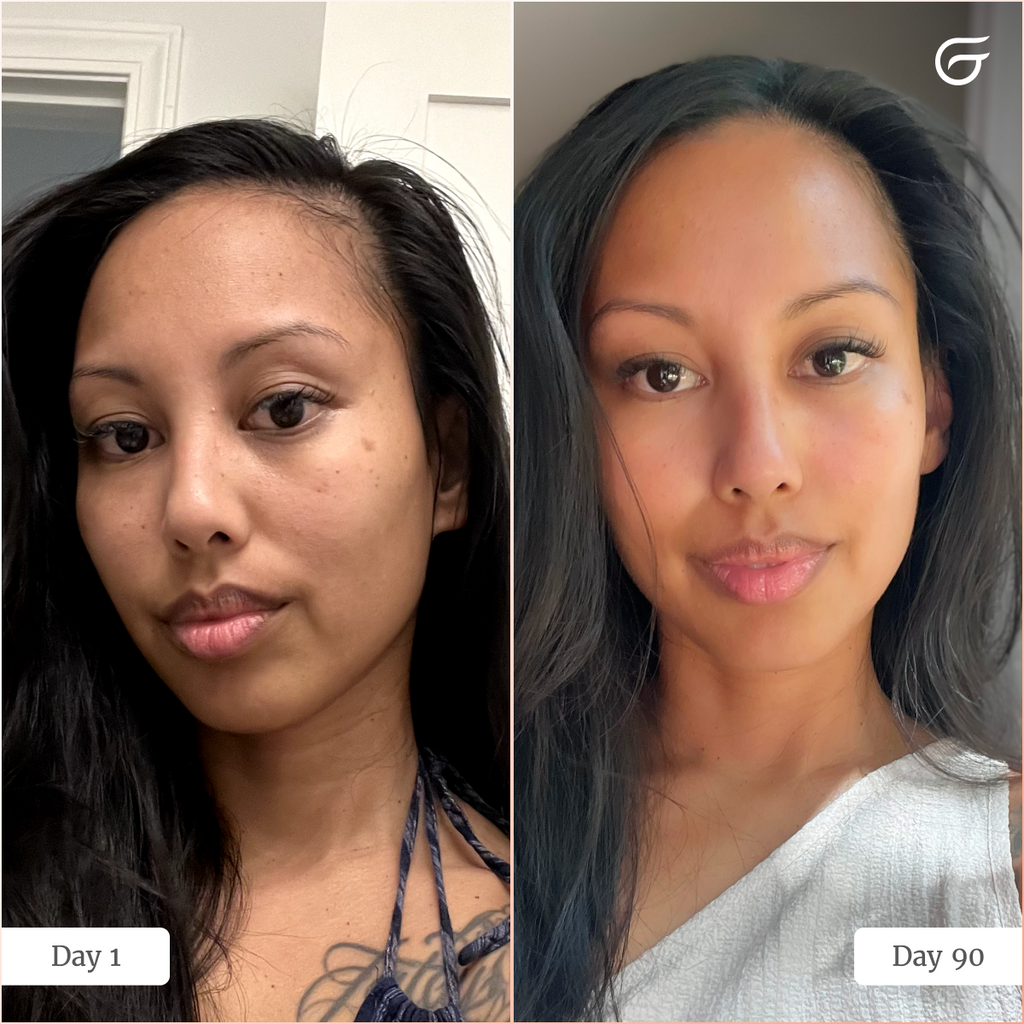 GlowUp™ LED Light Therapy Face Mask